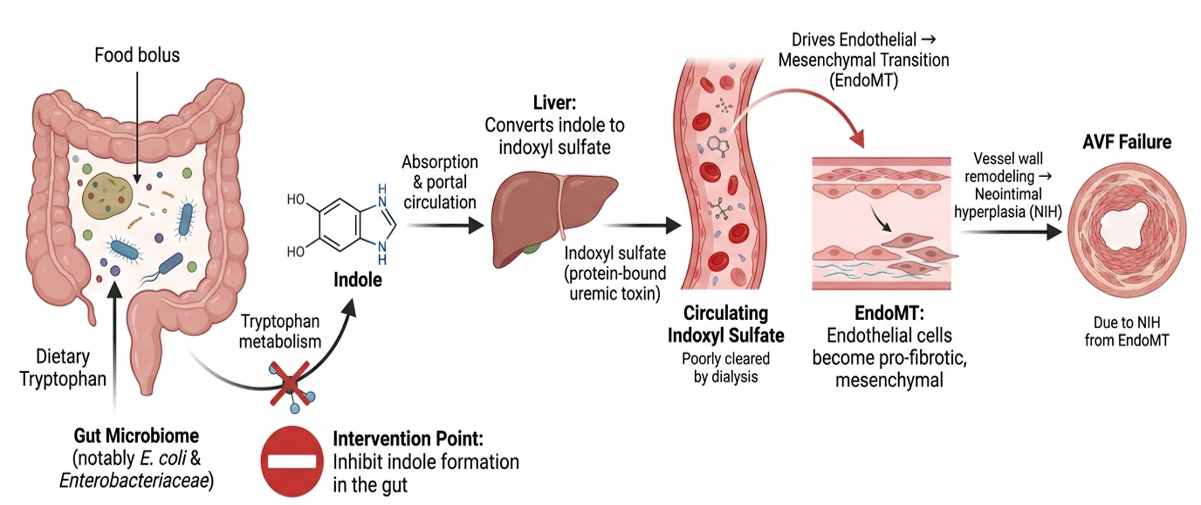 Diagram showing how gut microbial indole production leads to circulating indoxyl sulfate, vascular remodeling, and arteriovenous fistula failure